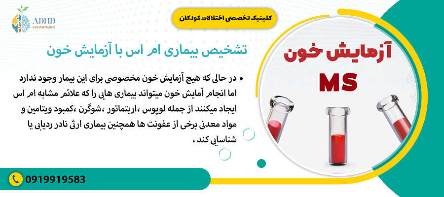 تشخیص بیماری ام اس با آزمایش خون